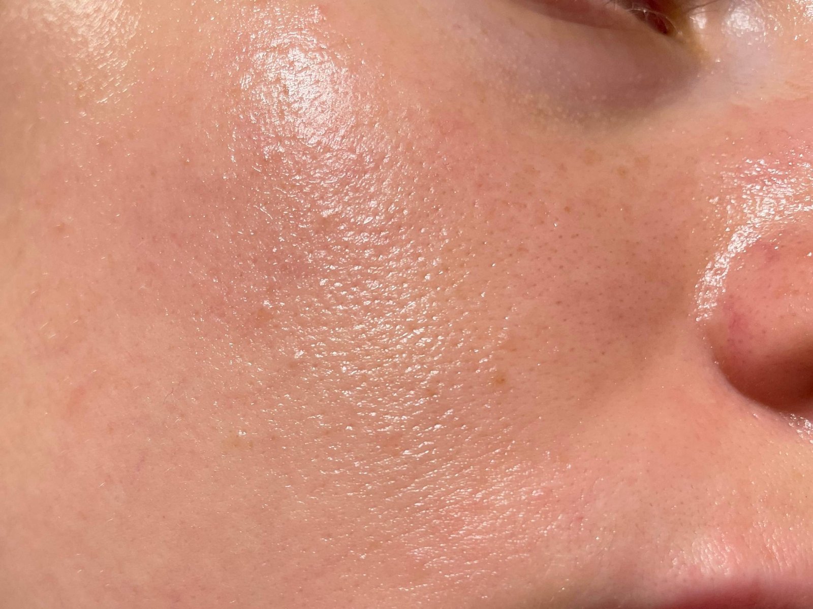 Oily